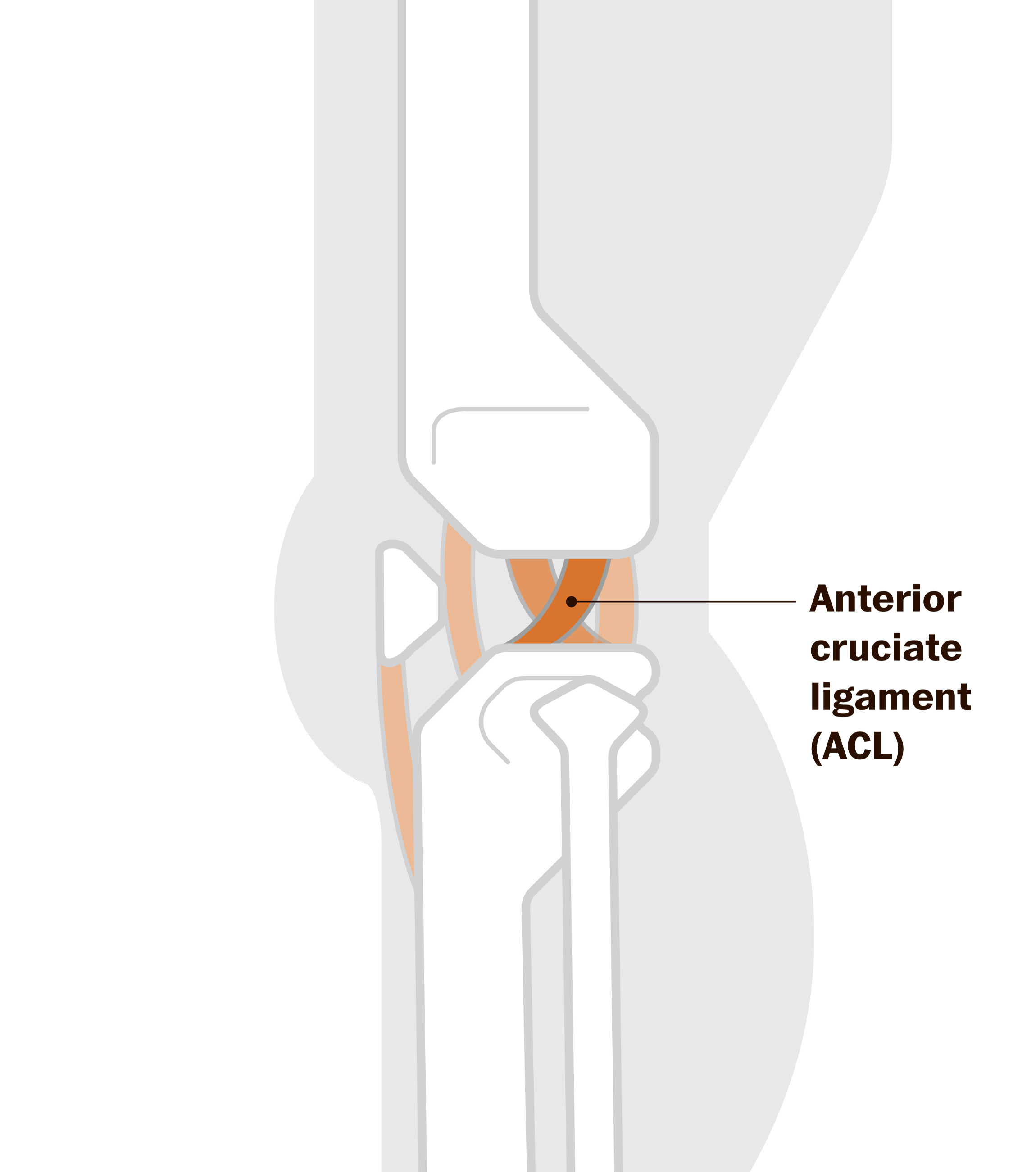 How to take care of your knees from 20, 30, 40 and beyond 2 How to take care of your knees from 20, 30, 40 and beyond